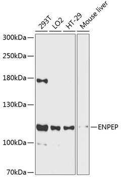 WB analysis of various sample lysates using GTX66100 Aminopeptidase A antibody. Dilution : 1:3000 Loading : 25microg per lane WB analysis of various sample lysates using GTX66100 Aminopeptidase A antibody. Dilution : 1:3000 Loading : 25microg per lane