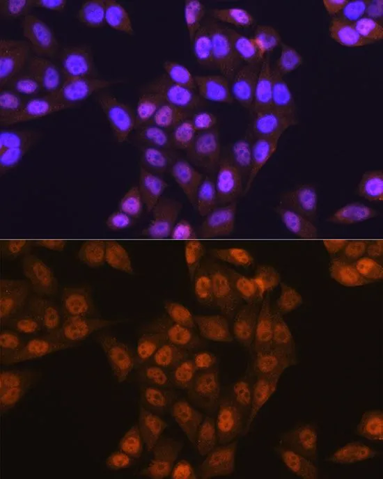 ICC/IF analysis of HeLa cells using GTX66102 UBE1 antibody. Blue : DAPI Dilution : 1:100