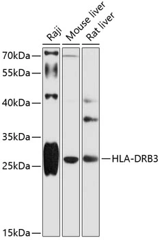 WB analysis of various sample lysates using GTX66104 HLA-DRB3 antibody. Dilution : 1:1000 Loading : 25microg per lane WB analysis of various sample lysates using GTX66104 HLA-DRB3 antibody. Dilution : 1:1000 Loading : 25microg per lane