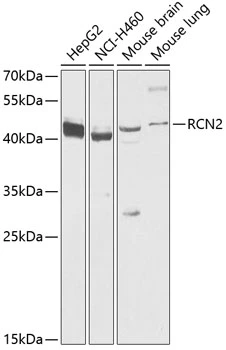 WB analysis of various sample lysates using GTX66107 RCN2 antibody. Dilution : 1:1000 Loading : 25microg per lane WB analysis of various sample lysates using GTX66107 RCN2 antibody. Dilution : 1:1000 Loading : 25microg per lane