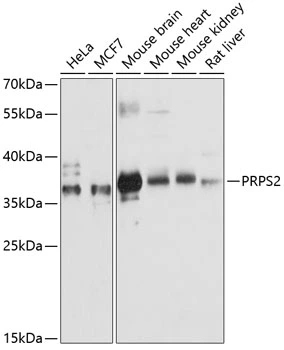 WB analysis of various sample lysates using GTX66111 PRPS2 antibody. Dilution : 1:3000 Loading : 25microg per lane WB analysis of various sample lysates using GTX66111 PRPS2 antibody. Dilution : 1:3000 Loading : 25microg per lane