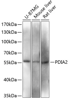 WB analysis of various sample lysates using GTX66116 PDIA2 / PDIP antibody. Dilution : 1:3000 Loading : 25microg per lane WB analysis of various sample lysates using GTX66116 PDIA2 / PDIP antibody. Dilution : 1:3000 Loading : 25microg per lane