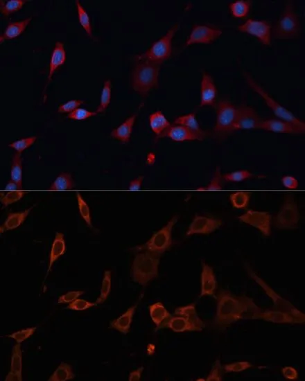 ICC/IF analysis of NIH/3T3 cells using GTX66116 PDIA2 / PDIP antibody. Blue : DAPI Dilution : 1:100
