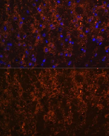 IHC-P analysis of mouse brain tissue using GTX66121 SNX13 antibody. Blue : DAPI Dilution : 1:100