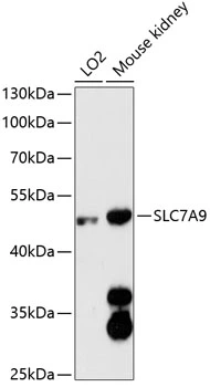 WB analysis of various sample lysates using GTX66127 SLC7A9 antibody. The signal was developed with ECL plus-Enhanced. Dilution : 1:3000 Loading : 25microg per lane WB analysis of various sample lysates using GTX66127 SLC7A9 antibody. The signal was developed with ECL plus-Enhanced. Dilution : 1:3000 Loading : 25microg per lane