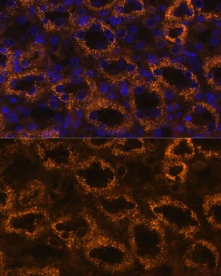 IHC-P analysis of rat kidney tissue using GTX66127 SLC7A9 antibody. Blue : DAPI Dilution : 1:100 IHC-P analysis of rat kidney tissue using GTX66127 SLC7A9 antibody. Blue : DAPI Dilution : 1:100