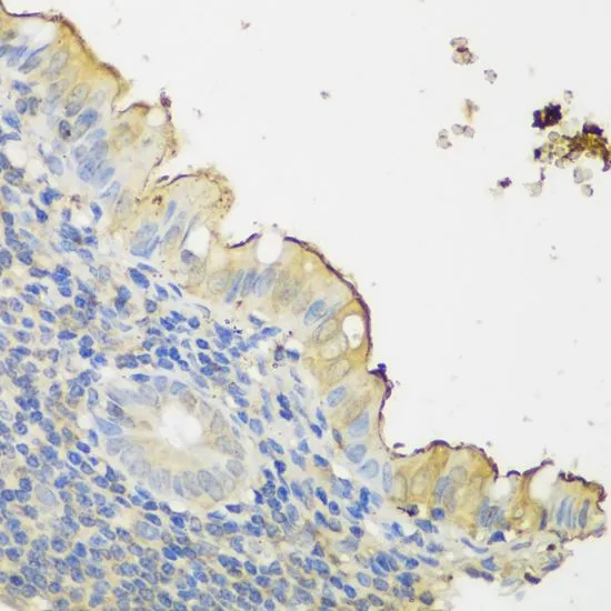 IHC-P analysis of human appendix tissue using GTX66133 CLN5 antibody. Dilution : 1:150