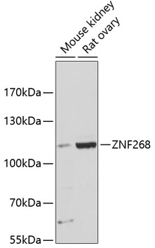 WB analysis of various sample lysates using GTX66137 ZNF268 antibody. Dilution : 1:3000 Loading : 25microg per lane WB analysis of various sample lysates using GTX66137 ZNF268 antibody. Dilution : 1:3000 Loading : 25microg per lane
