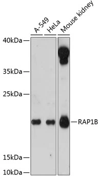 WB analysis of various sample lysates using GTX66139 RAP1B antibody. The signal was developed with ECL plus-Enhanced. Dilution : 1:3000 Loading : 25microg per lane
