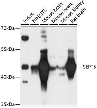 WB analysis of various sample lysates using GTX66146 SEPT5 antibody. Dilution : 1:3000 Loading : 25microg per lane WB analysis of various sample lysates using GTX66146 SEPT5 antibody. Dilution : 1:3000 Loading : 25microg per lane