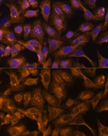 ICC/IF analysis of U2OS cells using GTX66146 SEPT5 antibody. Blue : DAPI Dilution : 1:100