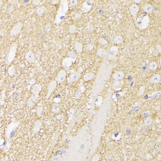 IHC-P analysis of mouse brain tissue using GTX66146 SEPT5 antibody. Dilution : 1:100
