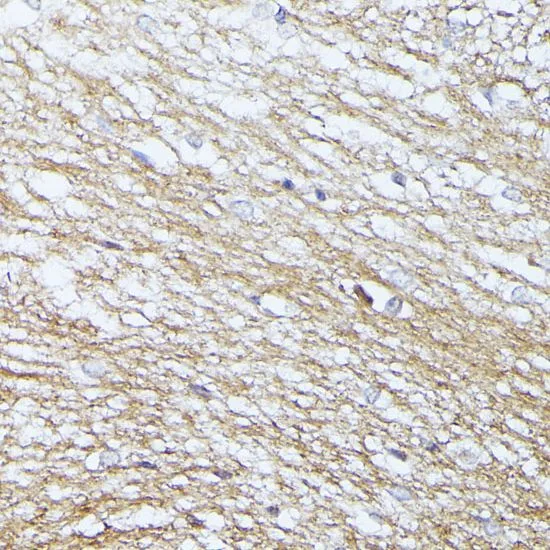 IHC-P analysis of rat brain tissue using GTX66146 SEPT5 antibody. Dilution : 1:100