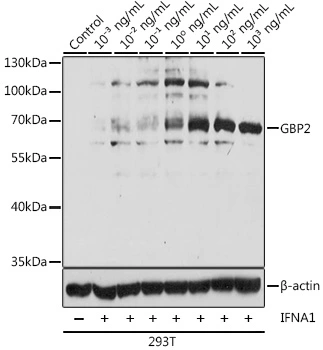 WB analysis of 293T cells treated with different concentrations of IFNA1 using GTX66148 GBP2 antibody. Dilution : 1:1000 Loading : 25microg per lane WB analysis of 293T cells treated with different concentrations of IFNA1 using GTX66148 GBP2 antibody. Dilution : 1:1000 Loading : 25microg per lane