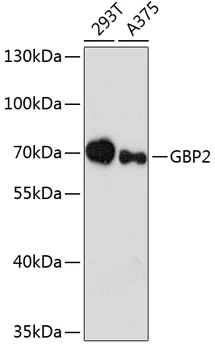 WB analysis of various sample lysates using GTX66148 GBP2 antibody. The signal was developed with ECL plus-Enhanced. Dilution : 1:3000 Loading : 25microg per lane