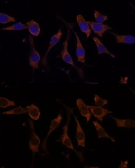 ICC/IF analysis of L929 cells using GTX66149 RPL32 antibody. Blue : DAPI Dilution : 1:100