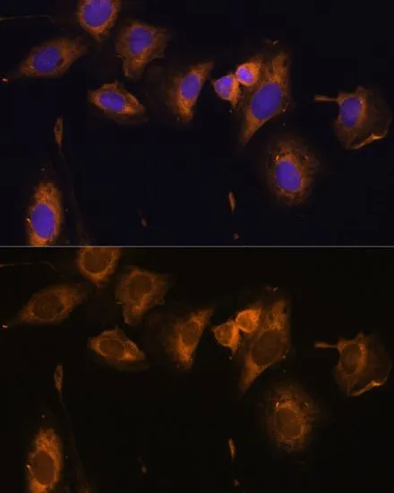 ICC/IF analysis of U2OS cells using GTX66149 RPL32 antibody. Blue : DAPI Dilution : 1:100