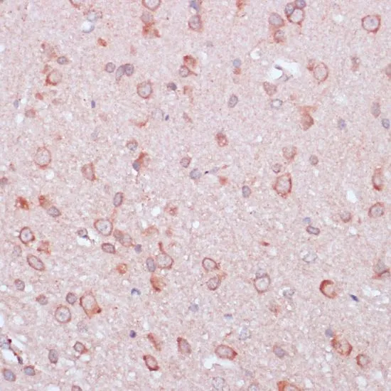 IHC-P analysis of rat brain tissue using GTX66149 RPL32 antibody. Dilution : 1:100
