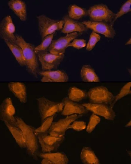 ICC/IF analysis of U2OS cells using GTX66153 RPL27 antibody. Blue : DAPI Dilution : 1:100