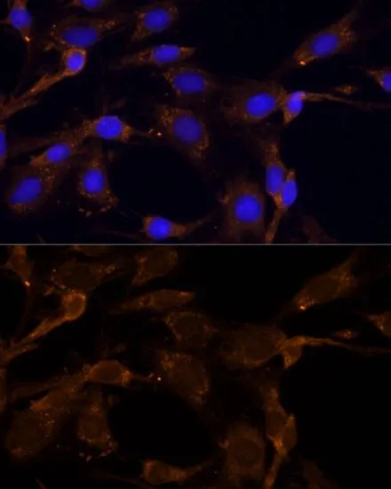 ICC/IF analysis of C6 cells using GTX66153 RPL27 antibody. Blue : DAPI Dilution : 1:100