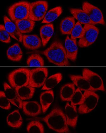 ICC/IF analysis of HeLa cells using GTX66153 RPL27 antibody. Blue : DAPI Dilution : 1:200