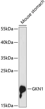 WB analysis of mouse stomach tissue lysate using GTX66162 Gastrokine 1 antibody. Dilution : 1:3000 Loading : 25microg per lane WB analysis of mouse stomach tissue lysate using GTX66162 Gastrokine 1 antibody. Dilution : 1:3000 Loading : 25microg per lane