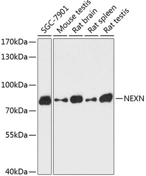 WB analysis of various sample lysates using GTX66168 NEXN antibody. Dilution : 1:3000 Loading : 25microg per lane WB analysis of various sample lysates using GTX66168 NEXN antibody. Dilution : 1:3000 Loading : 25microg per lane