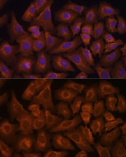 ICC/IF analysis of U2OS cells using GTX66168 NEXN antibody. Blue : DAPI Dilution : 1:100
