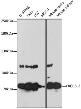 WB analysis of various sample lysates using GTX66172 RAD26L antibody. The signal was developed with ECL plus-Enhanced. Dilution : 1:3000 Loading : 25microg per lane WB analysis of various sample lysates using GTX66172 RAD26L antibody. The signal was developed with ECL plus-Enhanced. Dilution : 1:3000 Loading : 25microg per lane