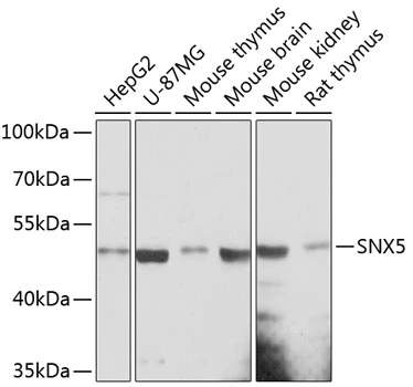 WB analysis of various sample lysates using GTX66173 SNX5 antibody. Dilution : 1:3000 Loading : 25microg per lane WB analysis of various sample lysates using GTX66173 SNX5 antibody. Dilution : 1:3000 Loading : 25microg per lane