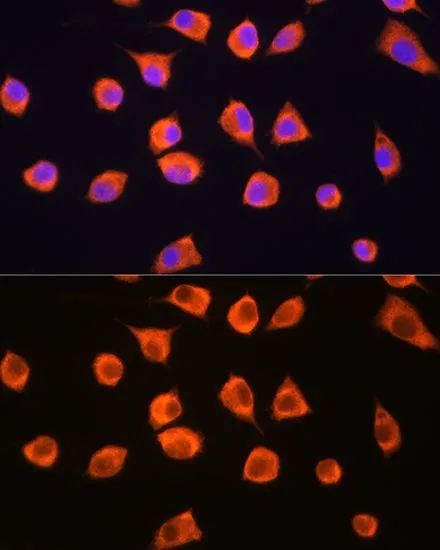 ICC/IF analysis of L929 cells using GTX66174 SCYL2 antibody. Blue : DAPI Dilution : 1:100
