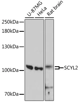 WB analysis of various sample lysates using GTX66175 SCYL2 antibody. The signal was developed with ECL plus-Enhanced. Dilution : 1:3000 Loading : 25microg per lane WB analysis of various sample lysates using GTX66175 SCYL2 antibody. The signal was developed with ECL plus-Enhanced. Dilution : 1:3000 Loading : 25microg per lane