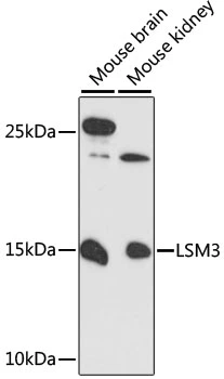 WB analysis of various sample lysates using GTX66179 LSM3 antibody. The signal was developed with ECL plus-Enhanced. Dilution : 1:3000 Loading : 25microg per lane WB analysis of various sample lysates using GTX66179 LSM3 antibody. The signal was developed with ECL plus-Enhanced. Dilution : 1:3000 Loading : 25microg per lane