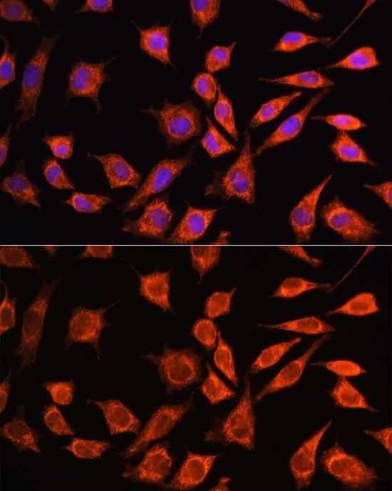 ICC/IF analysis of L929 cells using GTX66181 MRPL45 antibody. Blue : DAPI Dilution : 1:100