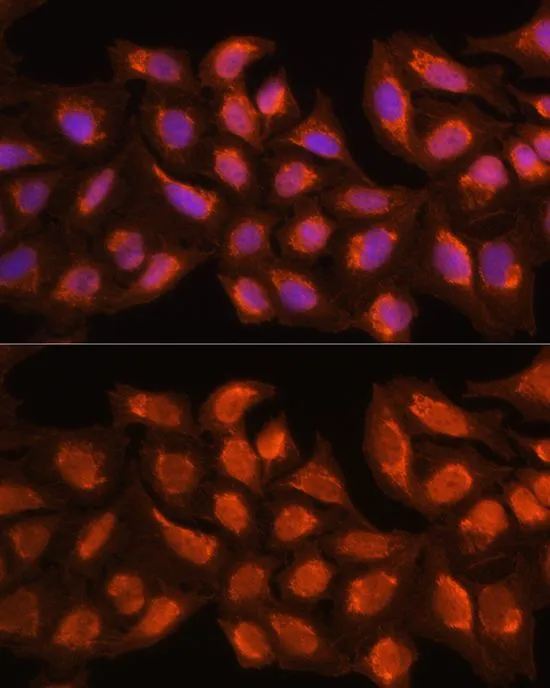 ICC/IF analysis of HeLa cells using GTX66181 MRPL45 antibody. Blue : DAPI Dilution : 1:100