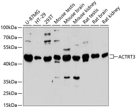 WB analysis of various sample lysates using GTX66182 ARPM1 antibody. Dilution : 1:3000 Loading : 25microg per lane WB analysis of various sample lysates using GTX66182 ARPM1 antibody. Dilution : 1:3000 Loading : 25microg per lane