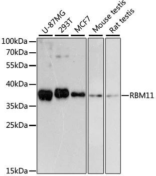 WB analysis of various sample lysates using GTX66184 RBM11 antibody. Dilution : 1:3000 Loading : 25microg per lane WB analysis of various sample lysates using GTX66184 RBM11 antibody. Dilution : 1:3000 Loading : 25microg per lane