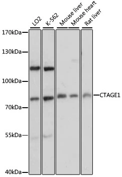 WB analysis of various sample lysates using GTX66185 CTAGE1 antibody. Dilution : 1:3000 Loading : 25microg per lane WB analysis of various sample lysates using GTX66185 CTAGE1 antibody. Dilution : 1:3000 Loading : 25microg per lane