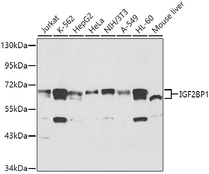 WB analysis of various sample lysates using GTX66193 IGF2BP1 antibody. Dilution : 1:1000 Loading : 25microg per lane