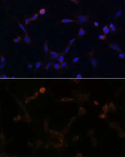 ICC/IF analysis of NIH/3T3 cells using GTX66195 UBE2L6 antibody. Blue : DAPI Dilution : 1:100