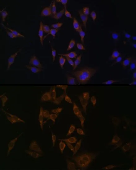 ICC/IF analysis of HeLa cells using GTX66195 UBE2L6 antibody. Blue : DAPI Dilution : 1:100