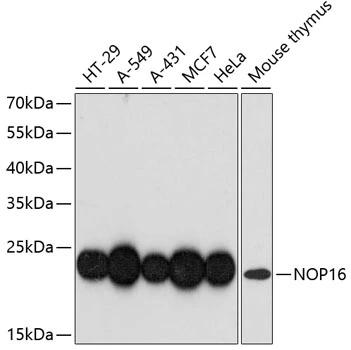 WB analysis of various sample lysates using GTX66197 HSPC111 antibody. The signal was developed with ECL plus-Enhanced. Dilution : 1:3000 Loading : 25microg per lane WB analysis of various sample lysates using GTX66197 HSPC111 antibody. The signal was developed with ECL plus-Enhanced. Dilution : 1:3000 Loading : 25microg per lane