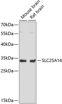 WB analysis of various sample lysates using GTX66201 SLC25A14 antibody. Dilution : 1:3000 Loading : 25microg per lane WB analysis of various sample lysates using GTX66201 SLC25A14 antibody. Dilution : 1:3000 Loading : 25microg per lane