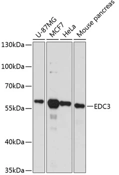 WB analysis of various sample lysates using GTX66203 Edc3 antibody. Dilution : 1:3000 Loading : 25microg per lane WB analysis of various sample lysates using GTX66203 Edc3 antibody. Dilution : 1:3000 Loading : 25microg per lane