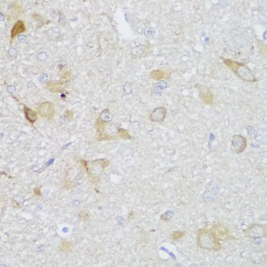 IHC-P analysis of rat brain tissue using GTX66203 Edc3 antibody. Dilution : 1:150