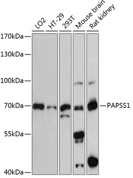 WB analysis of various sample lysates using GTX66205 PAPSS1 antibody. Dilution : 1:3000 Loading : 25microg per lane WB analysis of various sample lysates using GTX66205 PAPSS1 antibody. Dilution : 1:3000 Loading : 25microg per lane