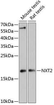 WB analysis of various sample lysates using GTX66213 NXT2 antibody. The signal was developed with ECL plus-Enhanced. Dilution : 1:3000 Loading : 25microg per lane WB analysis of various sample lysates using GTX66213 NXT2 antibody. The signal was developed with ECL plus-Enhanced. Dilution : 1:3000 Loading : 25microg per lane