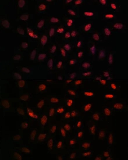 ICC/IF analysis of U2OS cells using GTX66213 NXT2 antibody. Blue : DAPI Dilution : 1:100