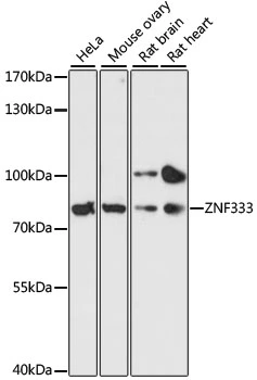 WB analysis of various sample lysates using GTX66216 ZNF333 antibody. Dilution : 1:3000 Loading : 25microg per lane WB analysis of various sample lysates using GTX66216 ZNF333 antibody. Dilution : 1:3000 Loading : 25microg per lane
