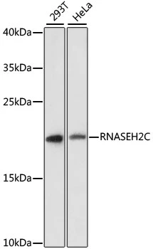 WB analysis of various sample lysates using GTX66221 RNASEH2C antibody. The signal was developed with ECL plus-Enhanced. Dilution : 1:3000 Loading : 25microg per lane WB analysis of various sample lysates using GTX66221 RNASEH2C antibody. The signal was developed with ECL plus-Enhanced. Dilution : 1:3000 Loading : 25microg per lane